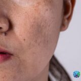 v-shaped face