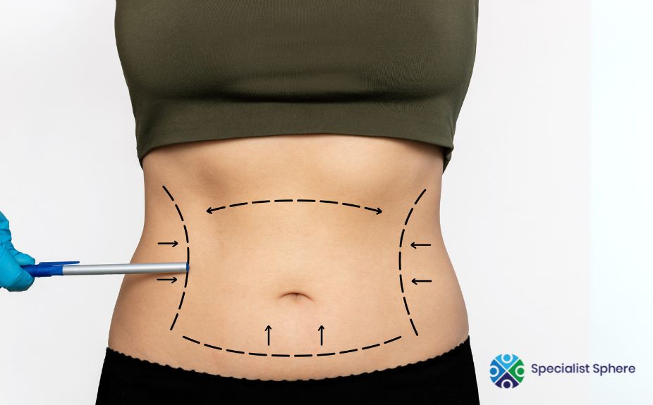 body contouring