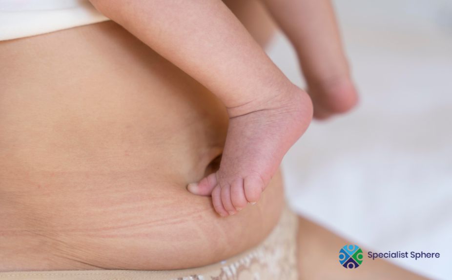 non-invasive body contouring